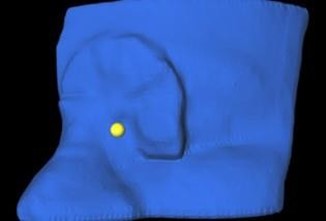 Visualization of the CAX reference point, created in Eclipse and imported into 3D Bolus.