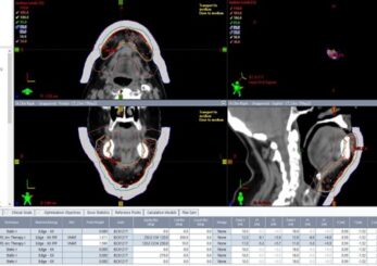 Figure 9. Daily CBCT review