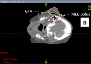 Figure 3. (B): Plan with a MEB