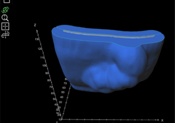 Figure 4: (A) The TrueFlex two-piece mould shown in blue, and the bolus material shown in translucent grey